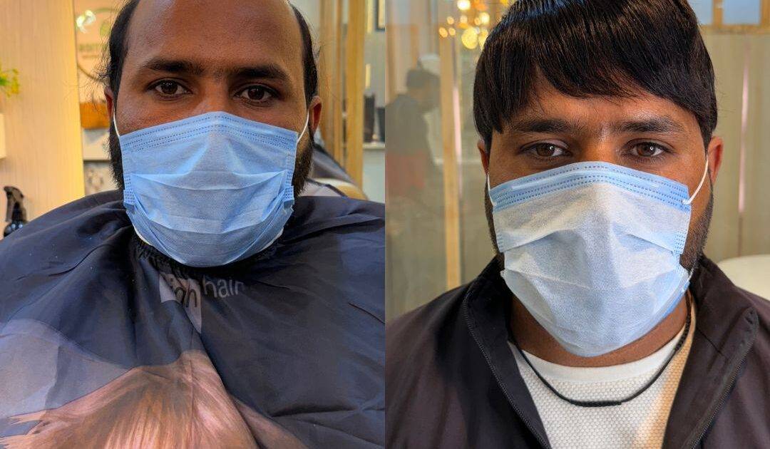 Men’s Hair Patch & Wigs