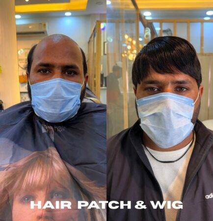 Men’s Hair Patch & Wigs