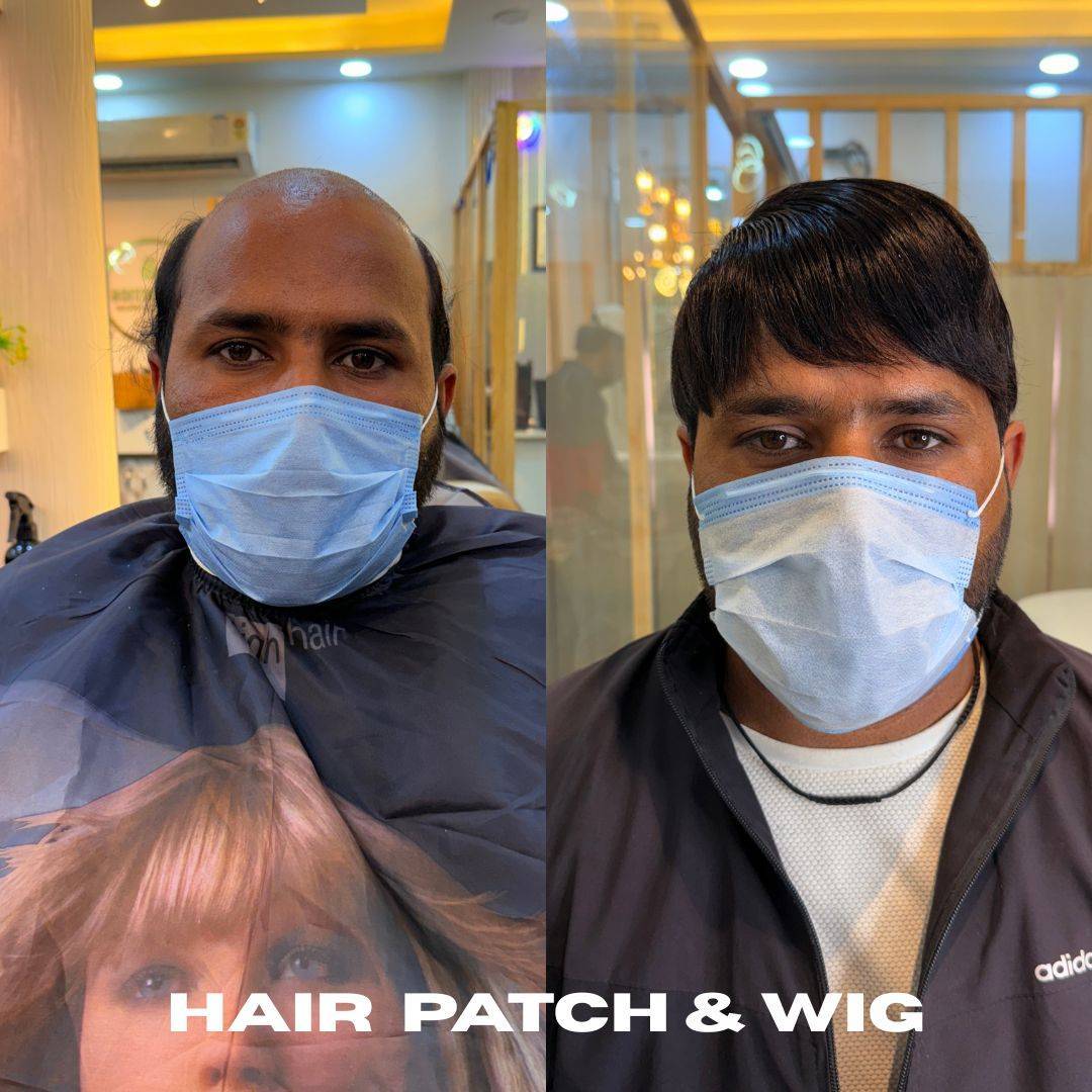 Men’s Hair Patch & Wigs