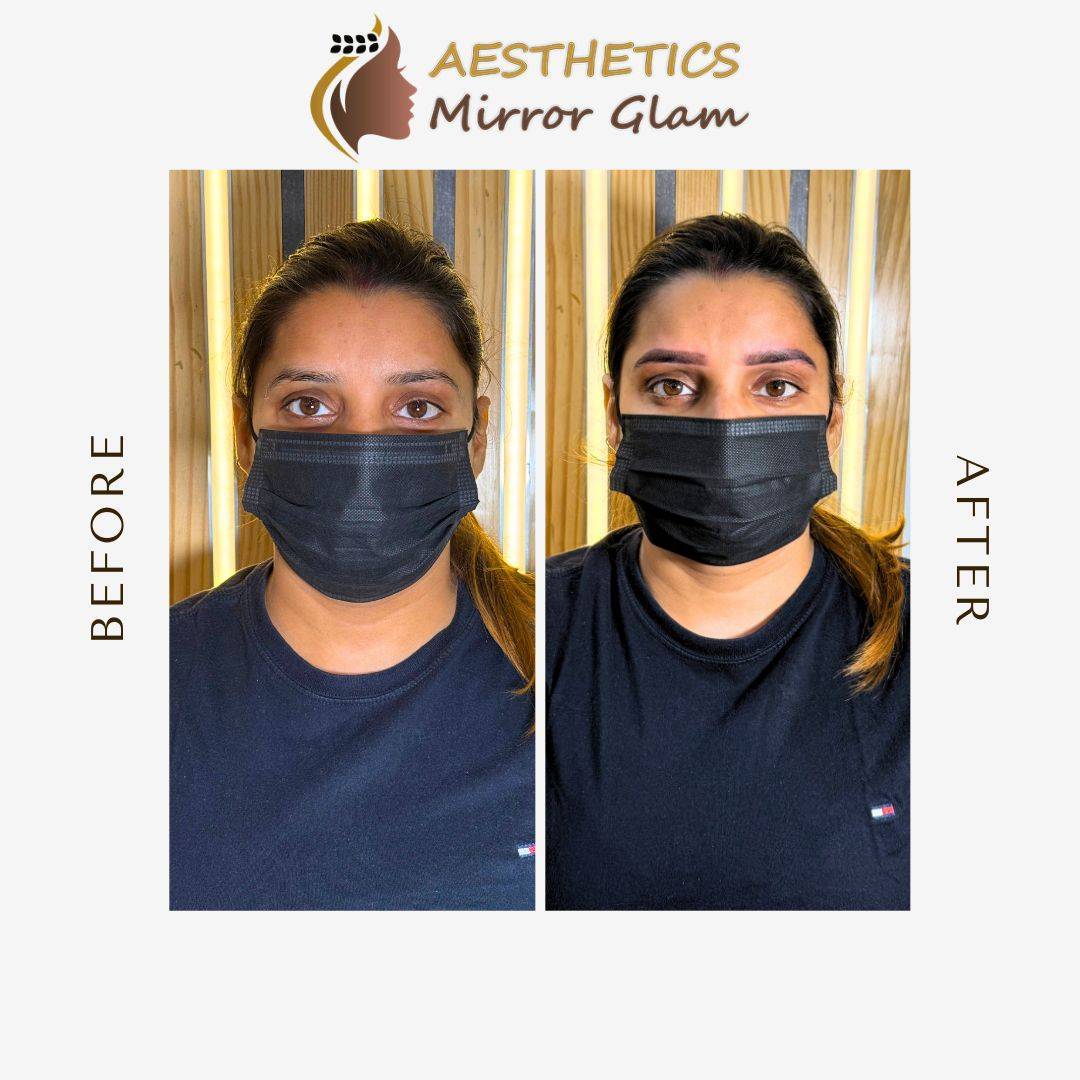 Black and White Minimalist Before After Beauty Instagram Post (1)