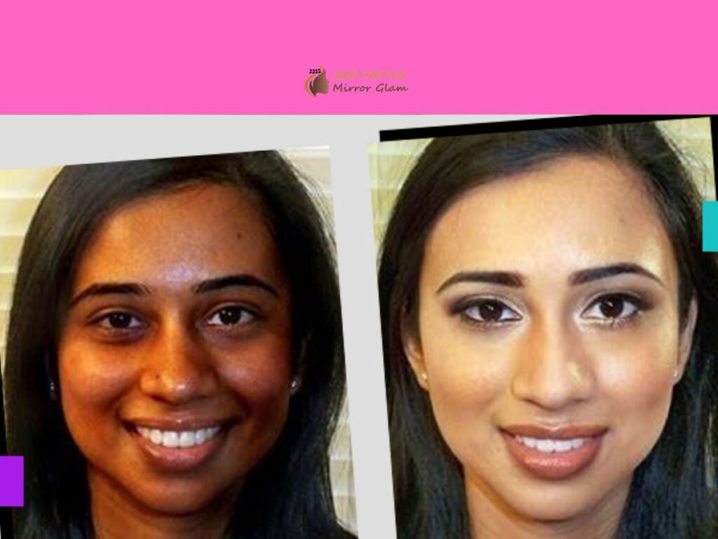 pigmentation 