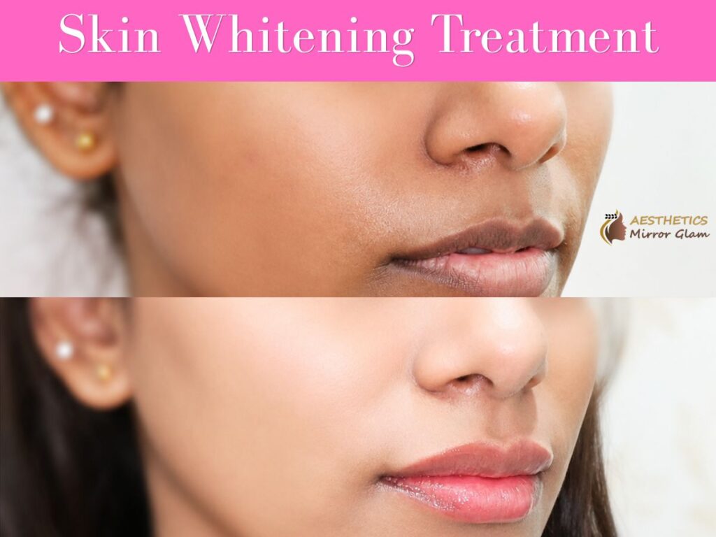 Best Collagen Treatment Near Me in Rohini Sector-24, Delhi