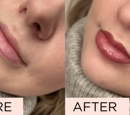 Lip Blush Treatment