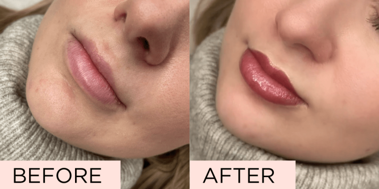 Lip Blush Treatment