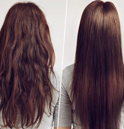 Hair treatment delhi