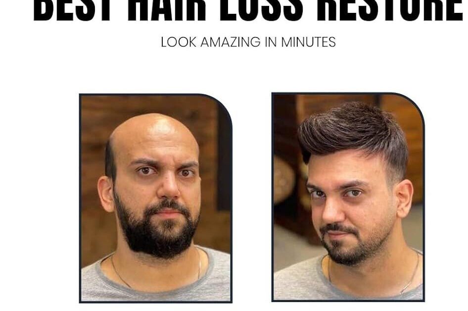 Hair loss has become one of the most common problems among men and women today. Stressful lifestyles, pollution, hormonal imbalance, poor diet, and genetic factors are some of the major reasons behind excessive hair fall. Many people struggle with thinning hair, receding hairlines, and bald patches, which can affect confidence and overall appearance. If you are searching for the best hair loss treatment in Faridabad, professional clinics now offer advanced, non-surgical solutions that can effectively control hair fall and stimulate natural hair regrowth. At Aesthetics Mirror Glam Studio, Faridabad, experts provide modern and personalized hair restoration treatments designed to improve scalp health and promote strong, healthy hair growth. This detailed guide will help you understand the causes of hair loss, available treatments, benefits, and why choosing the right clinic is important. Understanding Hair Loss Hair loss is medically known as alopecia, and it occurs when hair follicles weaken or stop producing new hair. Losing around 50–100 strands daily is normal, but excessive hair shedding can indicate an underlying problem. Hair loss can affect both men and women and may appear in different forms such as: Gradual thinning on the scalp Receding hairline Bald patches Sudden hair shedding Weak and brittle hair Early diagnosis and proper treatment can help prevent permanent hair loss. Common Causes of Hair Loss 1. Genetic Hair Loss Genetic hair loss, also known as androgenetic alopecia, is one of the most common causes. It usually results in: Male pattern baldness Female pattern thinning This condition gradually weakens hair follicles over time. 2. Hormonal Imbalance Hormonal changes caused by: Pregnancy Thyroid disorders PCOS Menopause can lead to severe hair fall. 3. Stress and Lifestyle Modern lifestyle habits play a major role in hair damage. Factors include: Lack of sleep Work stress Poor diet Smoking and alcohol These factors weaken the hair growth cycle. 4. Nutritional Deficiency Hair requires essential nutrients such as: Iron Biotin Protein Zinc Vitamin D Deficiency of these nutrients can result in excessive hair fall. 5. Scalp Infections Dandruff, fungal infections, and scalp inflammation can damage hair follicles and cause hair thinning. Signs You Need Hair Loss Treatment Many people ignore early symptoms of hair loss until the problem becomes severe. Some warning signs include: Hair fall during combing or washing Widening hair parting Visible scalp Receding hairline Thinning ponytail Bald patches If you notice these symptoms, consulting a specialist is recommended. Advanced Hair Loss Treatments in Faridabad 4 Modern hair restoration treatments focus on stimulating hair follicles and improving scalp health without surgery. At Aesthetics Mirror Glam Studio Faridabad, several advanced techniques are used for effective results. 1. PRP Hair Treatment PRP (Platelet-Rich Plasma) therapy is one of the most popular non-surgical hair loss treatments. How PRP Works A small amount of blood is drawn from the patient. The blood is processed in a centrifuge to extract platelet-rich plasma. The PRP is injected into the scalp. Benefits Stimulates natural hair growth Strengthens weak hair follicles Reduces hair fall Improves hair density PRP treatment is safe and widely recommended by hair specialists. 2. Hair Growth Therapy Hair growth therapy combines scalp treatments, medical solutions, and advanced equipment to boost hair growth. Benefits Improves blood circulation in the scalp Nourishes hair roots Strengthens hair follicles Promotes thicker hair This therapy works well for people experiencing early-stage hair thinning. 3. Scalp Treatment A healthy scalp is essential for strong hair growth. Professional scalp treatments remove buildup, excess oil, and dandruff. Key Benefits Deep scalp cleansing Reduced dandruff Improved hair growth Balanced scalp health 4. Hair Patch or Non-Surgical Hair Replacement 4 For people with severe baldness, hair patch treatment offers an instant solution. A hair patch is a customized hair system attached to the scalp using medical-grade adhesives or clips. Advantages Immediate hair transformation Natural appearance Non-surgical solution Affordable alternative to hair transplant Hair patches are especially popular among men experiencing advanced baldness. Benefits of Professional Hair Loss Treatment Choosing professional treatment provides several advantages. 1. Accurate Diagnosis Hair specialists analyze scalp condition and determine the exact cause of hair loss. 2. Customized Treatment Plan Each patient receives a personalized solution based on their hair type and condition. 3. Safe and Effective Techniques Modern clinics use advanced technology and dermatologist-approved procedures. 4. Long-Term Results Professional treatments strengthen hair roots and improve long-term hair growth. Why Choose Aesthetics Mirror Glam Studio in Faridabad 4 If you are looking for the best hair loss treatment in Faridabad, Aesthetics Mirror Glam Studio provides advanced solutions for hair restoration. Key Highlights ✔ Experienced hair specialists ✔ Advanced PRP hair therapy ✔ Non-surgical hair replacement ✔ Personalized scalp treatments ✔ Hygienic and modern clinic environment The clinic focuses on providing safe and effective hair restoration treatments for both men and women. Hair Care Tips to Prevent Hair Loss In addition to professional treatments, following a healthy hair care routine can prevent hair fall. Maintain a Healthy Diet Include foods rich in: Protein Iron Biotin Omega-3 fatty acids Reduce Heat Styling Frequent use of straighteners and curling tools can weaken hair roots. Use Mild Hair Products Avoid harsh chemicals and choose sulfate-free shampoos. Manage Stress Yoga, meditation, and exercise help control stress-related hair fall. Regular Scalp Massage Scalp massage improves blood circulation and promotes hair growth. Who Should Consider Hair Loss Treatment Hair restoration treatments are suitable for: Men with receding hairlines Women with thinning hair Individuals experiencing excessive hair fall People with bald patches Patients with weak hair growth Early treatment ensures better and faster results. How Long Does Hair Loss Treatment Take Treatment duration varies depending on the condition. Typical timeline: PRP Therapy: 3–6 sessions Hair Growth Treatment: 2–4 months Scalp Therapy: Monthly sessions Hair Patch: Instant results Hair regrowth usually becomes noticeable within 3–4 months. Cost of Hair Loss Treatment in Faridabad The cost depends on factors such as: Type of treatment Number of sessions Hair loss severity Technology used Non-surgical treatments like PRP and scalp therapy are generally more affordable than hair transplant procedures. For accurate pricing, consultation with a specialist is recommended. Final Thoughts Hair loss can be distressing, but modern aesthetic treatments have made it possible to restore hair effectively without surgery. From PRP therapy and scalp treatments to non-surgical hair replacement systems, advanced techniques now provide safe and reliable solutions. If you are experiencing hair fall, early treatment can prevent further damage and promote healthy hair growth. For the best hair loss treatment in Faridabad, visit Aesthetics Mirror Glam Studio, where experts provide personalized hair restoration solutions using the latest technology. Regain your confidence and achieve stronger, healthier hair with professional hair care treatments designed for long-lasting results.