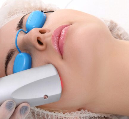 Acne Scar Treatment in Rohini