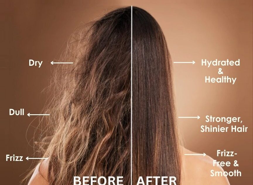 Hair Botox Treatment in Delhi