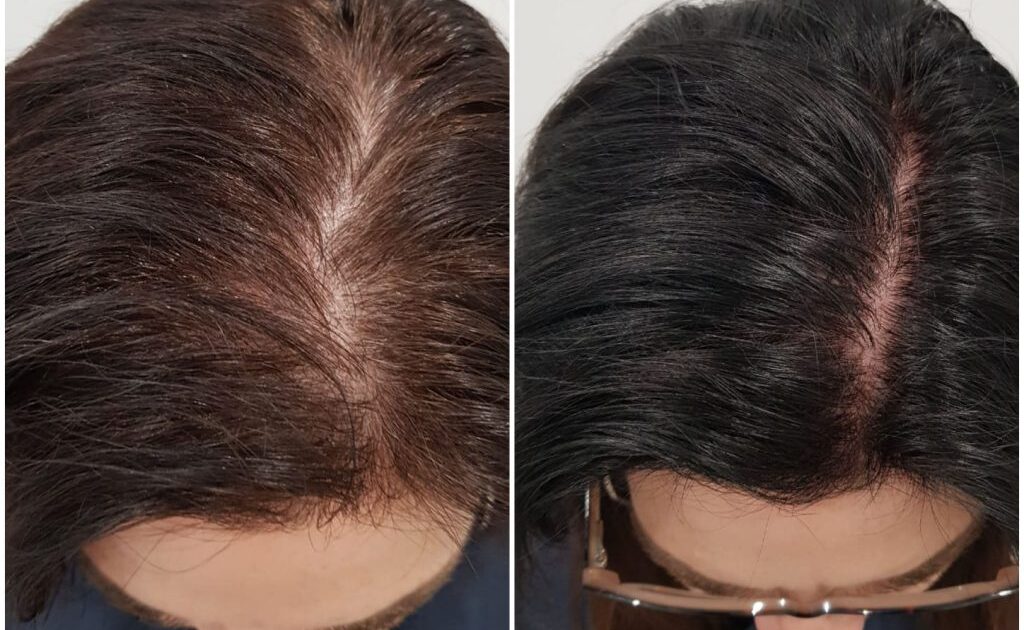 Before and after female