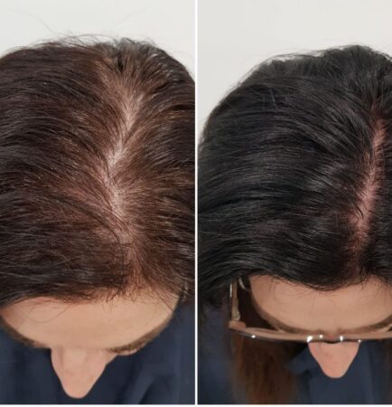 Before and after female