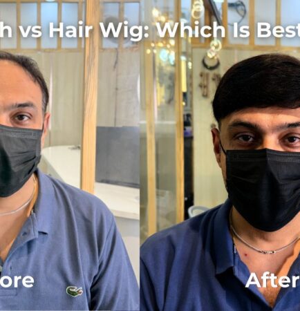 Hair Patch vs Hair Wig Which Is Best for You