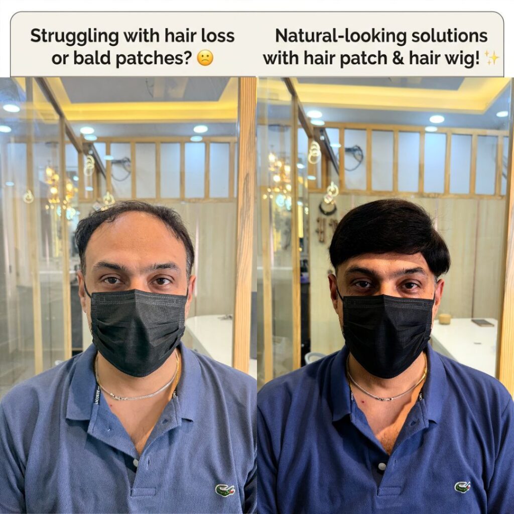 Man Patch and hair wig near me 