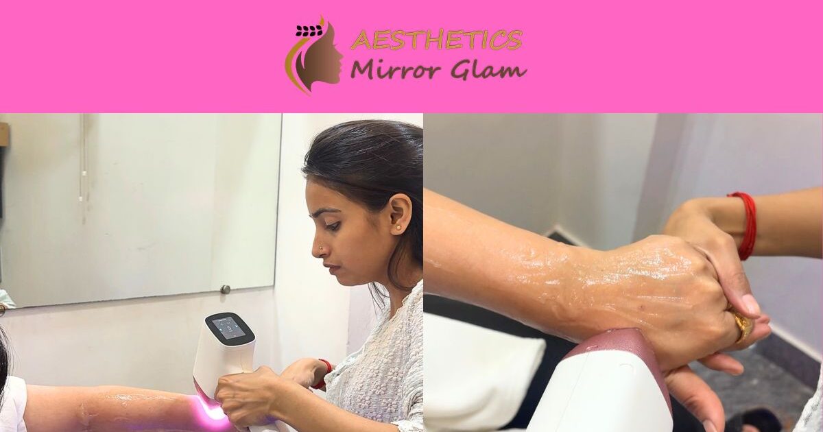 Permanent Hand Hair Removal for Women