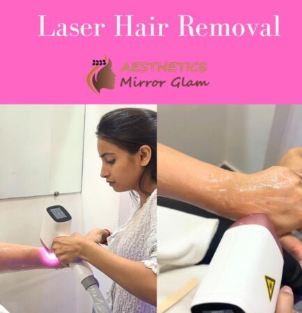 Permanent Hand Hair Removal for Women