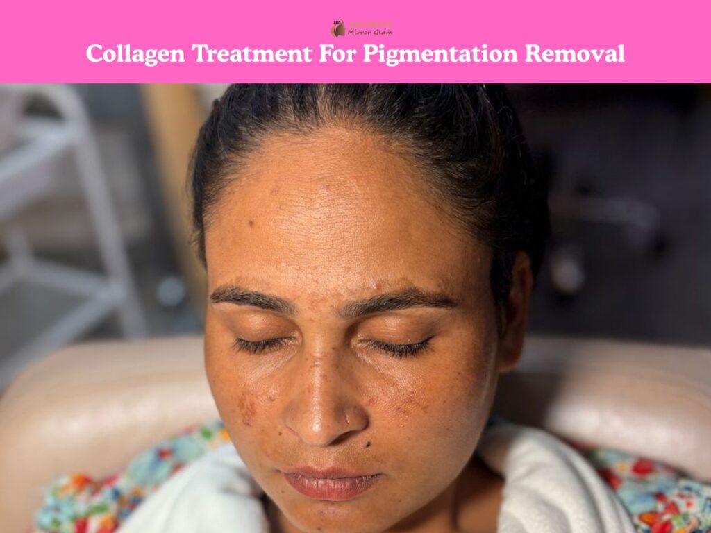 pigmentation removal challenge