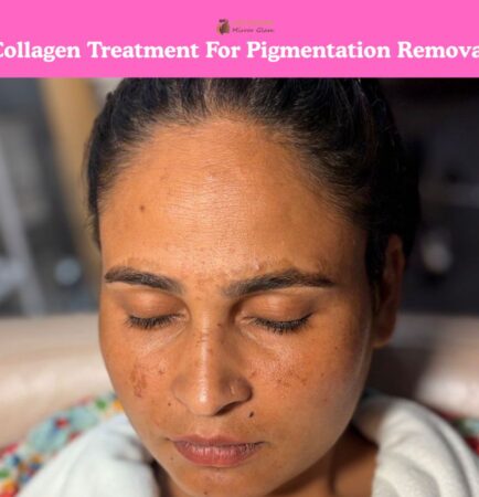 Collagen treatment for pigmentation removal