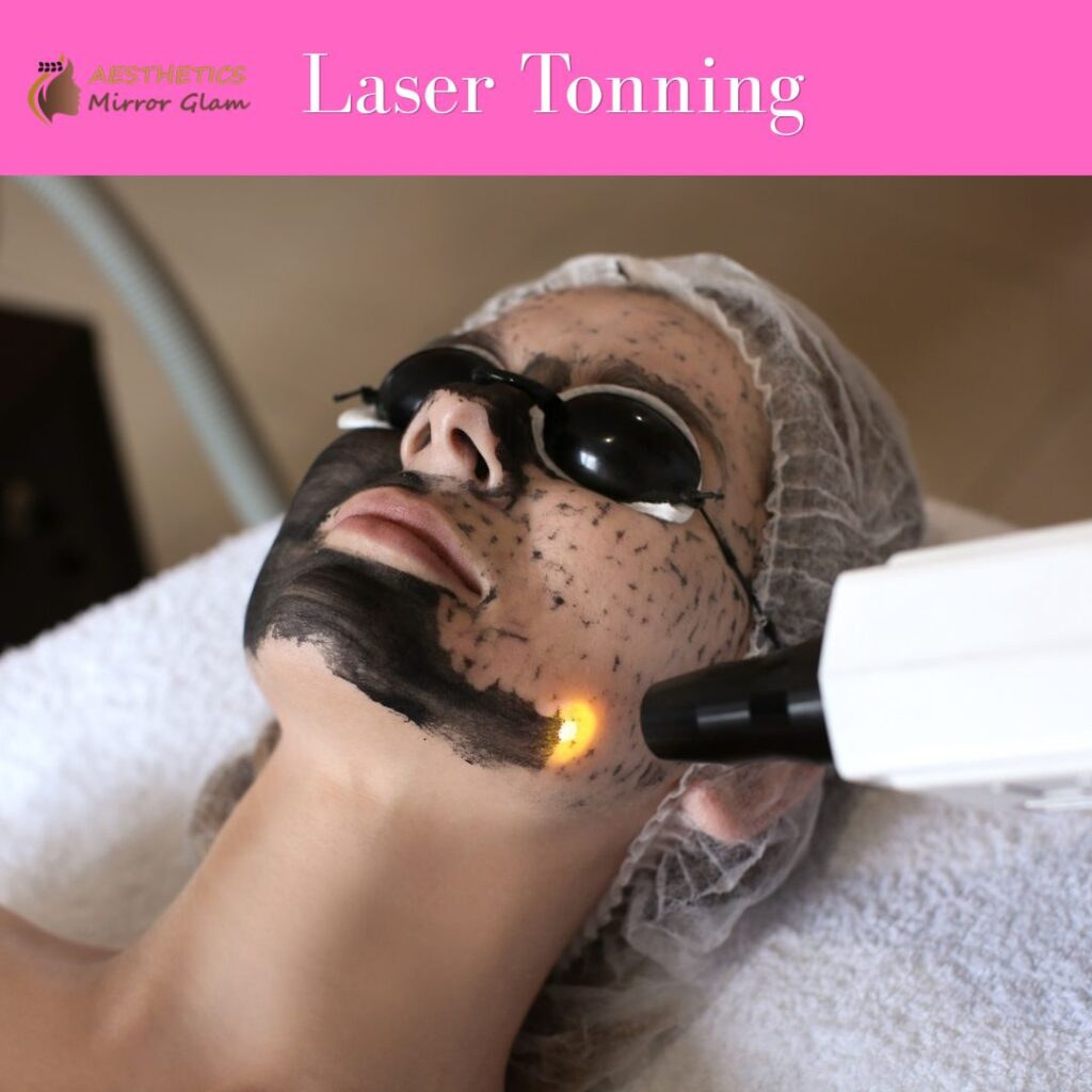 laser-tonning-near-me-carbon-facial-in-rohini-delhi