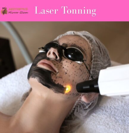 Carbon peel Laser tonning near me, carbon facial in rohini delhi