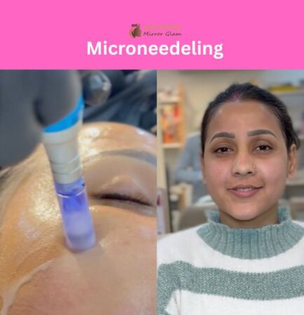 Microneedeling rohini delhi skin tightening