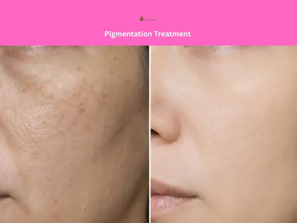 Important Tips During the 25 Days Pigmentation Treatment