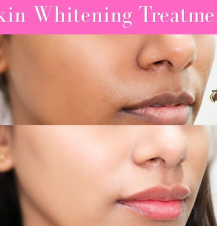 Skin whitening treatment delhi