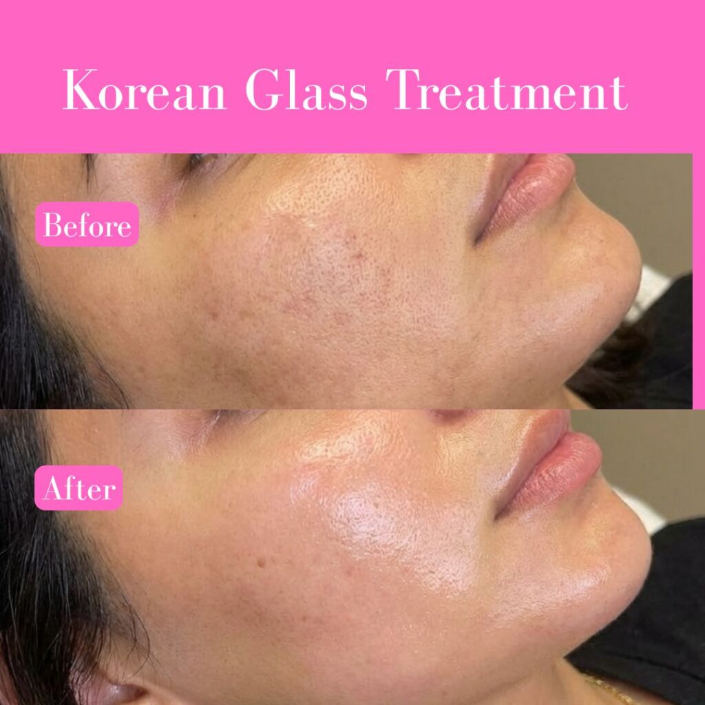 korean-glass-skin-facial-near-me-korean-glass-skin-facial-in-rohini-korean-glass-skin-facial