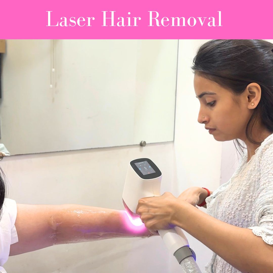 laser hair removal rohini delhi