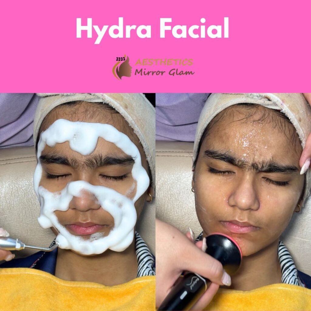 Best Hydra Facial Treatment in Rohini, Delhi