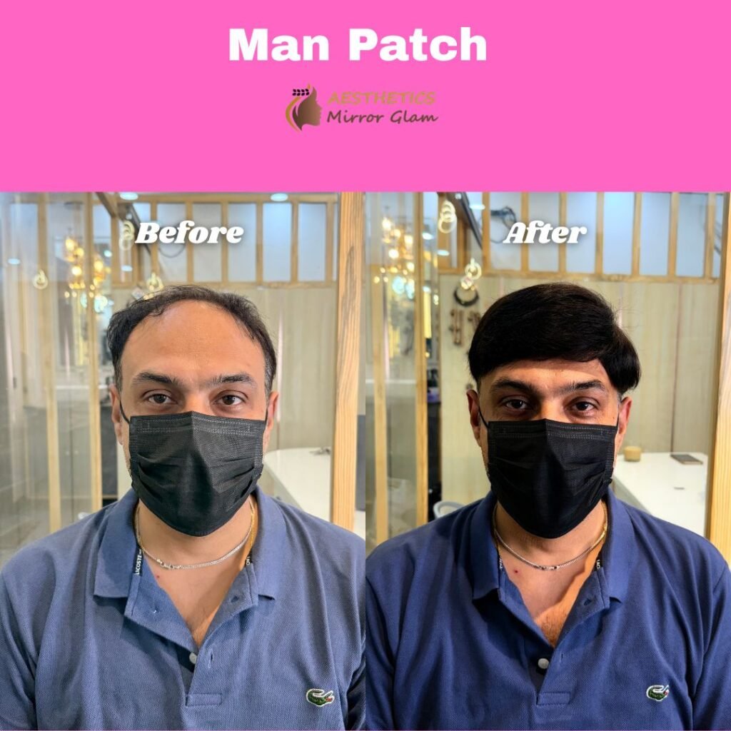 Man-patch-at-aesthetics-mirror-glam-studio-rohini
