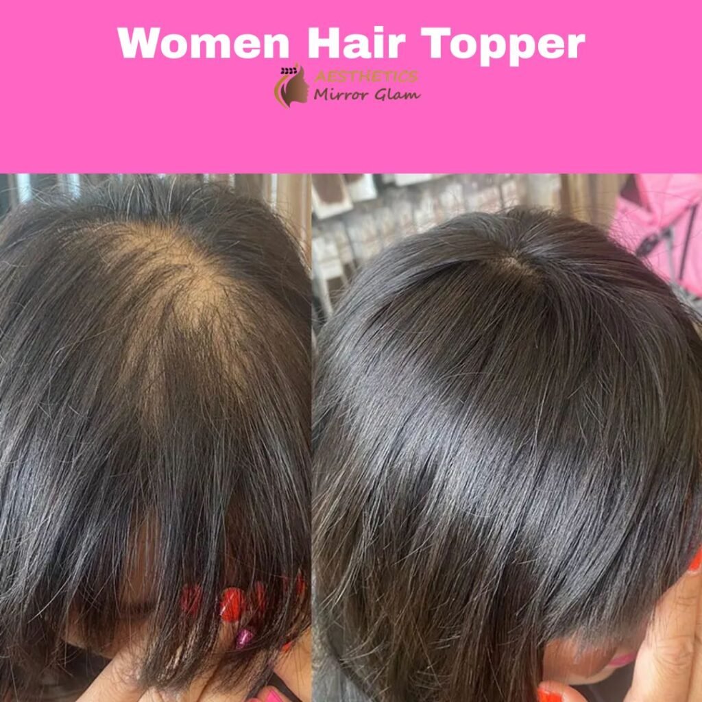 Women Hair Topper-at-aesthetics-mirror-glam-studio-rohini