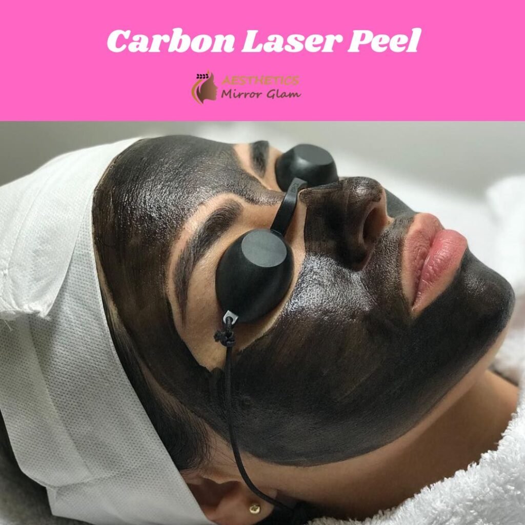 carbon facial rohini 