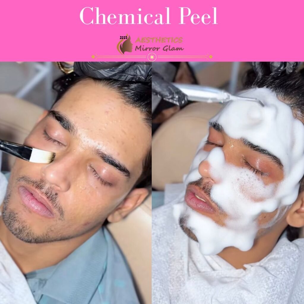 chemical peel in rohini, delhi