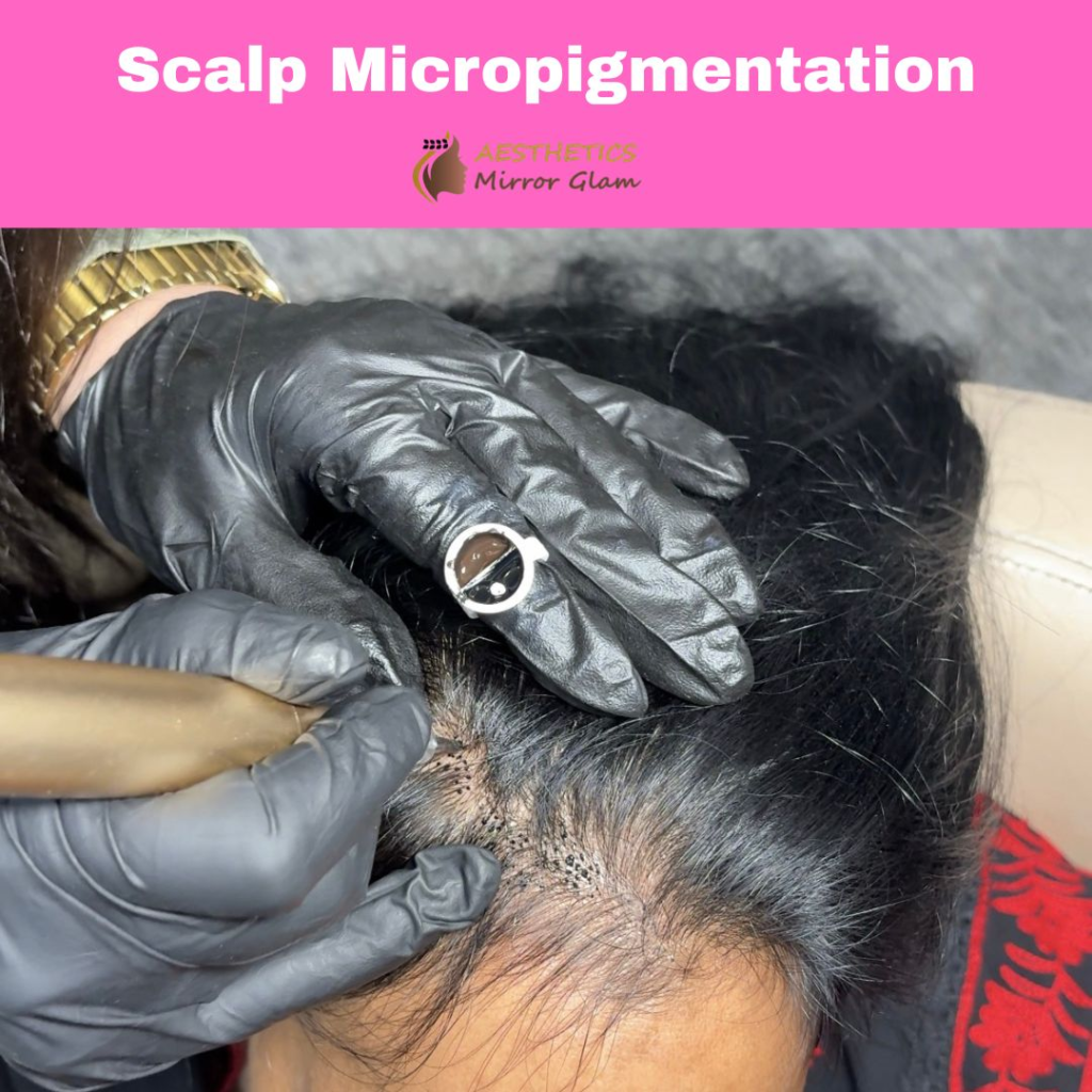 Scalp Micropigmentation process