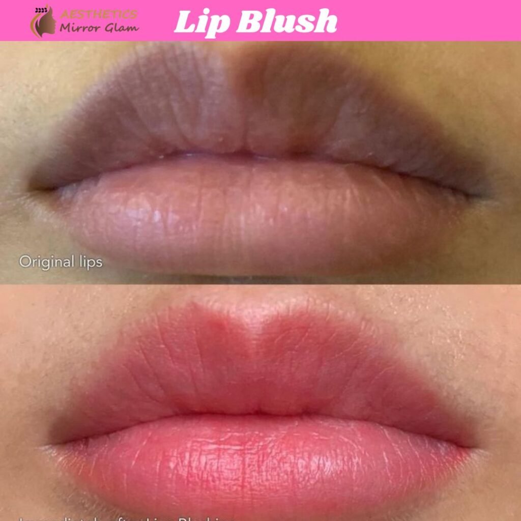 Lip blush treatment for dark lips in Rohini, Delhi at Aesthetics Mirror Glam Studio